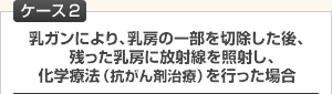 【ケース2】乳ガンにより、乳房の一部を切除した後、残った乳房に放射線を照射し、化学療法(抗がん剤治療)を行った場合